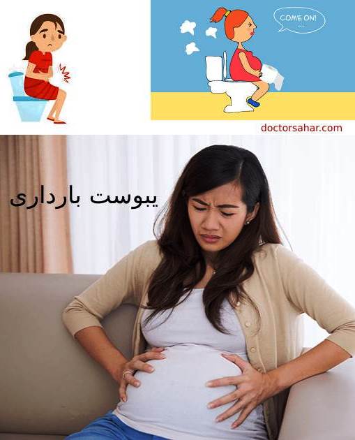 یبوست بارداری
