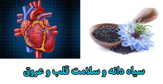 سیاه دانه کمک به سلامت قلب و عروق، پیشگیری از سکته قلبی